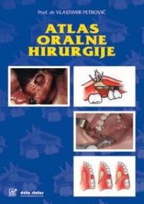 Atlas oralne hirurgije