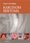 Karcinom rektuma