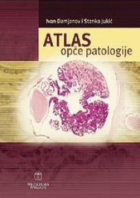 Atlas opće patologije Atlas opće patologije
