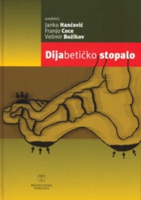 Dijabetičko stopalo Dijabetičko stopalo