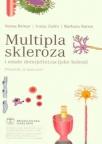 Multipla skleroza Multipla skleroza