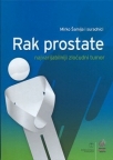 Rak prostate: Najvarijabilniji zloćudni tumor