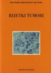 Rijetki tumori Rijetki tumori
