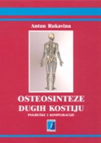 Osteosinteze dugih kostiju