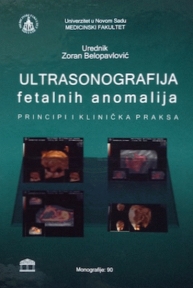 Ultrasonografija fetalnih anomalija