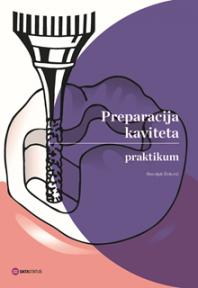 Preparacija kaviteta: praktikum