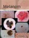 Melanom Melanom
