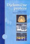 Djelomične proteze Djelomične proteze