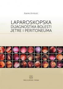 Laparoskopska dijagnostika bolesti jetre i peritoneuma