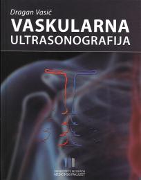 Vaskularna ultrasonografija