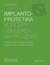 Implantoprotetika: Koncept usmjeren na pacijenta