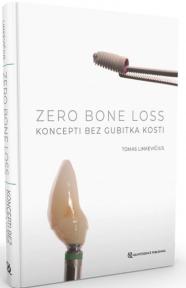 Zero Bone Loss: Koncepti bez gubitka kosti