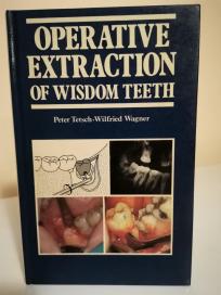 OPERATIVE EXTRACTION OF WISDOM TEETH