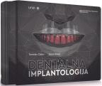 Dentalna implantologija