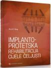 Implantoprotetska rehabilitacija cijele čeljusti