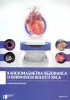 Kardiomagnetna rezonanca u ishemijskoj bolesti srca Kardiomagnetna rezonanca u ishemijskoj bolesti srca