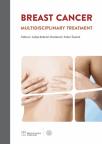 Breast cancer - multidisciplinary treatment Breast cancer - multidisciplinary treatment